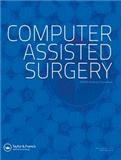Computer Assisted SurgeryпԺօ^(q)